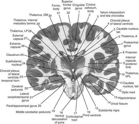 Nucleus Accumbens Coronal