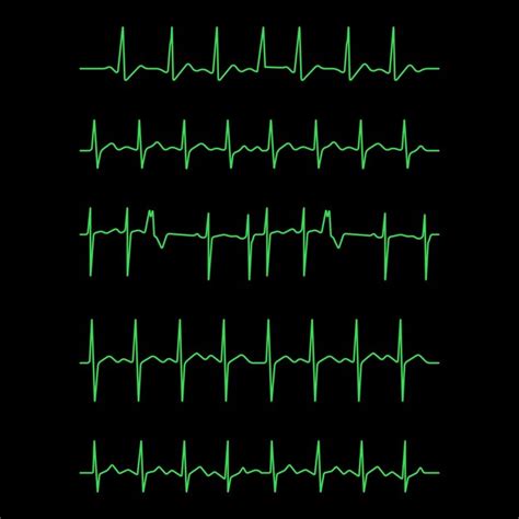 Conjunto De Líneas De Latido Del Corazón De Ecg De Vector Plano Vector Premium