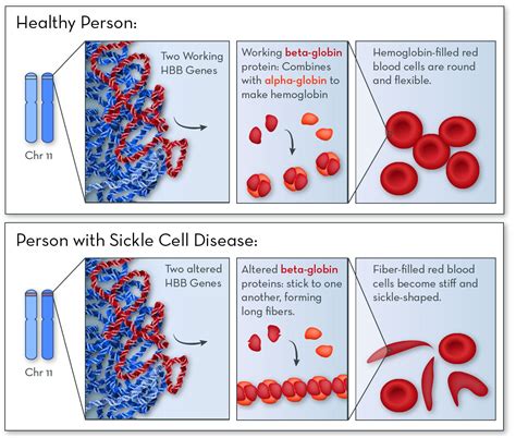 Examples Of Single Gene Disorders