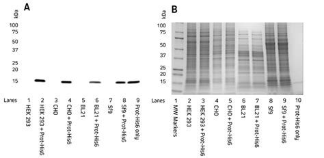 Western Blotting Guide Part Introduction And Sample Preparation