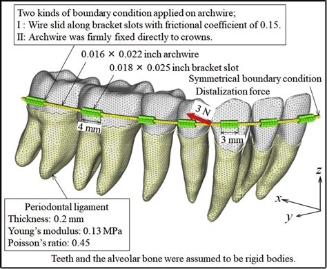 Finite Element Model For Simulating Orthodontic Tooth Movement Download Scientific Diagram