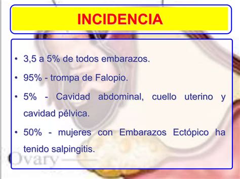 Aula 2 Embarazo Ectópico Ppt