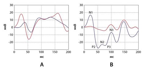 Examples of primary motor cortex responses evoked by electrical ...