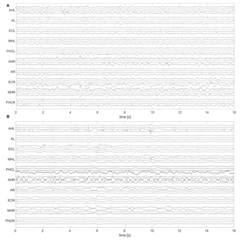 Exemplary 16 S Window Of An Eeg Recorded During Deep Sleep N3 With Download Scientific