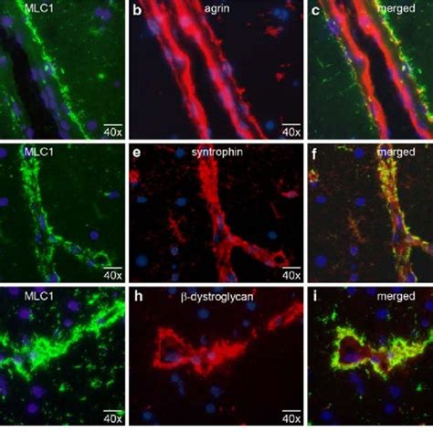 Co Localization Of Mlc And Dgc Proteins Ai Double Immuno Xuorescence