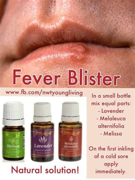 Cold Sore Essential Oils For Colds Yl Essential Oils Best Essential Oils