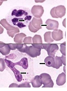 Blood Parasites Flashcards Quizlet