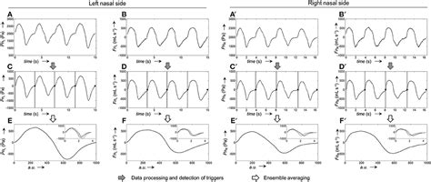 Frontiers Automatic Processing Of Nasal Pressure Recordings To Derive