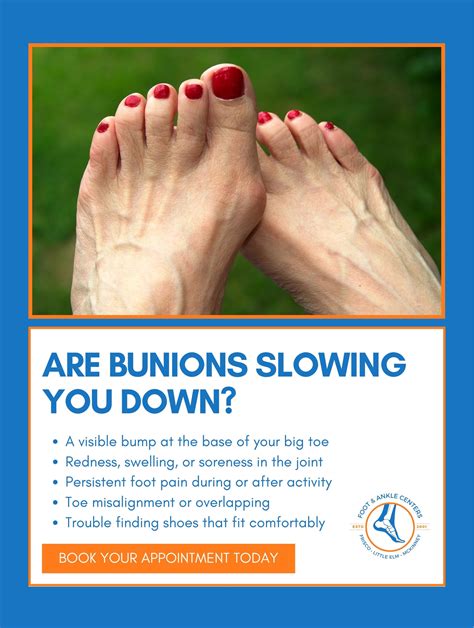 Bunions Slowing You Down? Get Help at Foot & Ankle Centers
