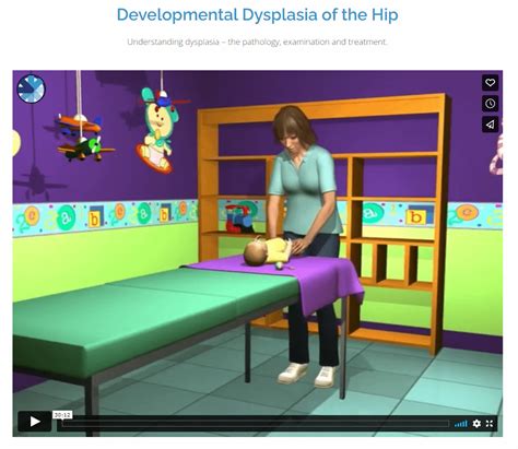 Teaching Portal International Hip Dysplasia Institute