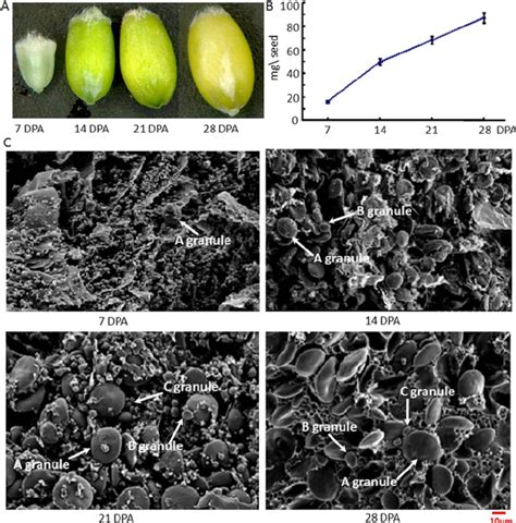 Grain development during four stages after anthesis in bread wheat ...