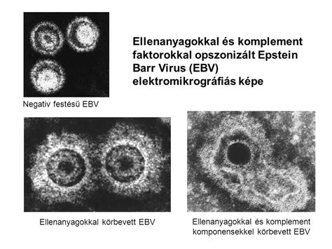 B Sejt Differenci Ci A Perif Ri N Szomatikus Hipermut Ci Ppt Let Lteni