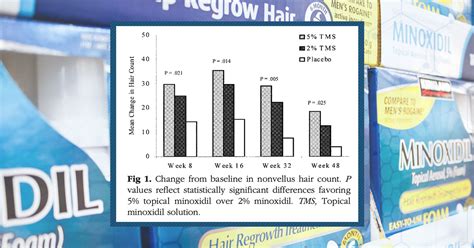 Topical Minoxidil Side Effects: What Should I Do? - Perfect Hair Health