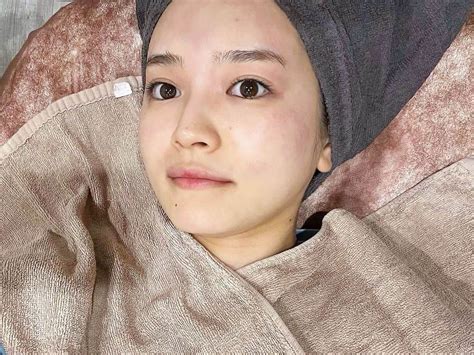 富久美玲さんのインスタグラム写真 富久美玲instagram「 今回ついに・・・！ 鼻にあったソバカスとおさらば👃👋 1枚目 施術後1週間経った今日！ 写真では分からない