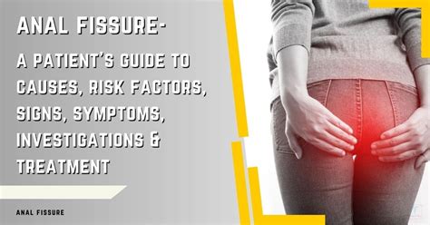 Causes Of Anal Fistula Complete Guide For Prevention Care