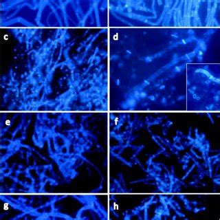 Fluorescence Photomicrographs Of The Cell Wall Samples Of Fusarium