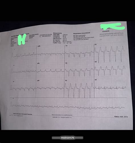 cardiologist   heart rate