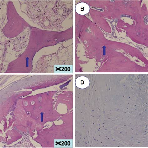 Histopathologic Evidence Of Heterotopic Ossification Hematoxylin And Download Scientific