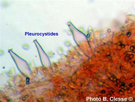 Microscopie Cystides De Pluteus Pouzarianus N Macau B Clesse