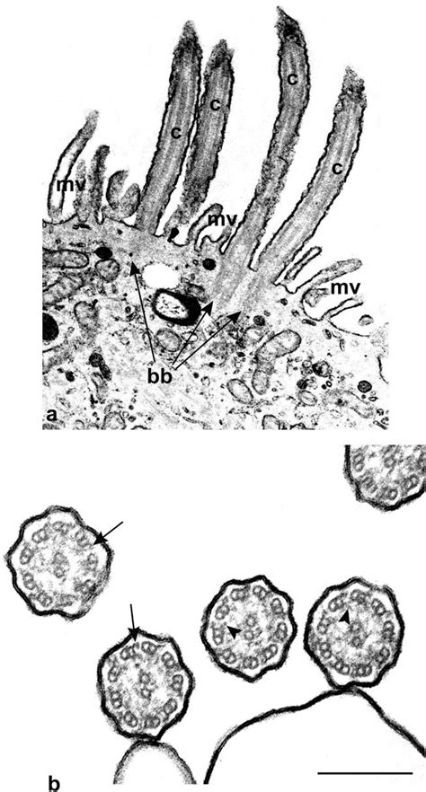 Tem Cilia From The Respiratory Tract In A 23 Year Old Woman The