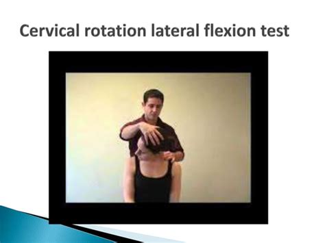 Thoracic Outlet Syndrome Ppt