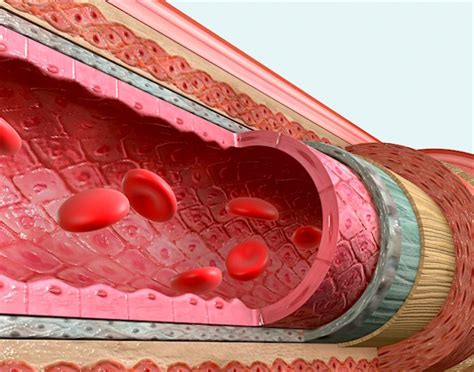 How Elevated Blood Sugar Levels Damage Blood Vessels To Trigger