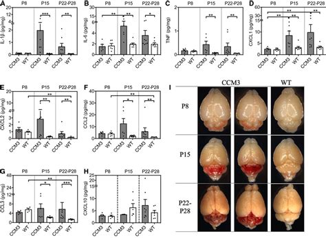 Proinflammatory Cytokines And Chemokines Mainly Associated With