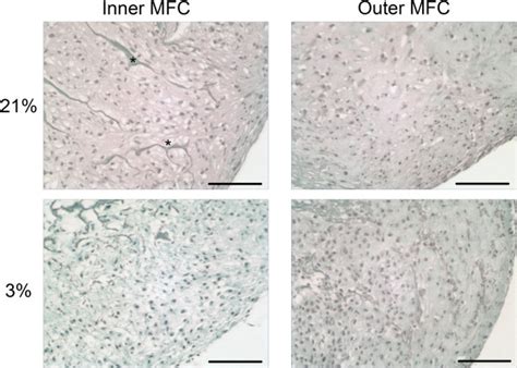 Deposition Of Sulfated Proteoglycan In D Constructs Inner And Outer