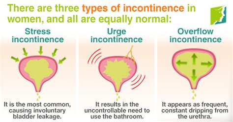 5 Little Known Facts About Incontinence In Women Bladder Leakage Urinary Incontinence