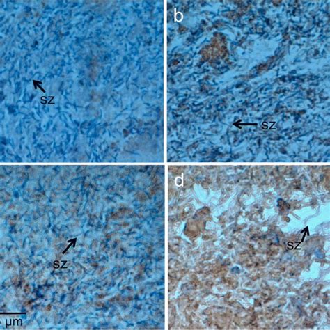 A Western blot analysis of β hexosaminidase Hex A expression in the