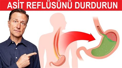 Asit Reflü Nasıl Anında Durdurulur Dr Berg Türkçe YouTube