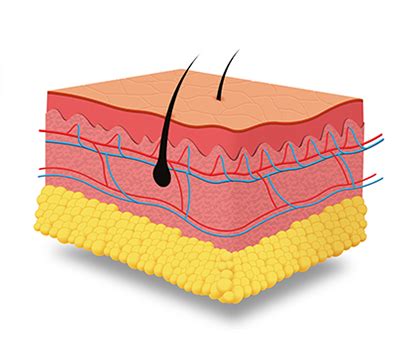 Medilase Pro laser diodowy do depilacji z czterema wiązkami PrismLaser