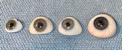 Custom Ocular Prosthesis