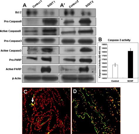 Western Blot Analysis Of Apoptosis Related Proteins And Tunel Assay In