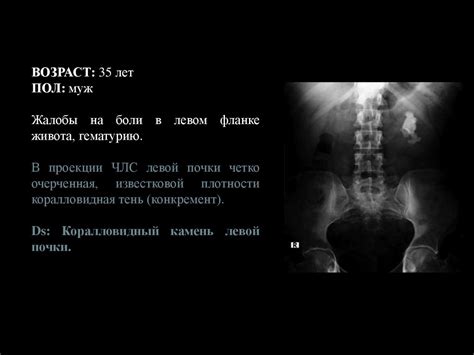 Комплексное лучевое исследование почек и мочевыводящих путей ...