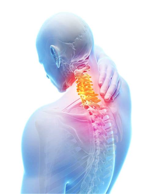 Whiplash Injury Treatment Back Pain Free Life