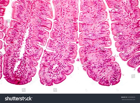 Villi Small Intestine Light Micrograph Magnification Stock Photo Edit