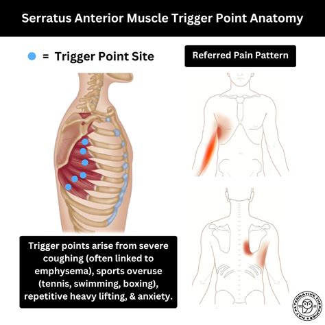 Abductors Strengthening Exercise | Abductors, Exercises, Strengthening ...