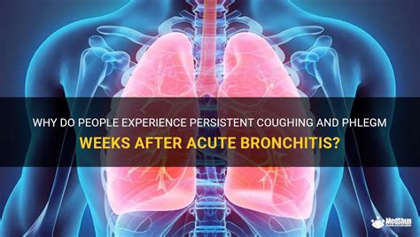 Why Do People Experience Persistent Coughing And Phlegm Weeks After