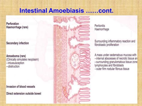 Ppt Amoebiasis Powerpoint Presentation Free Download Id9193597