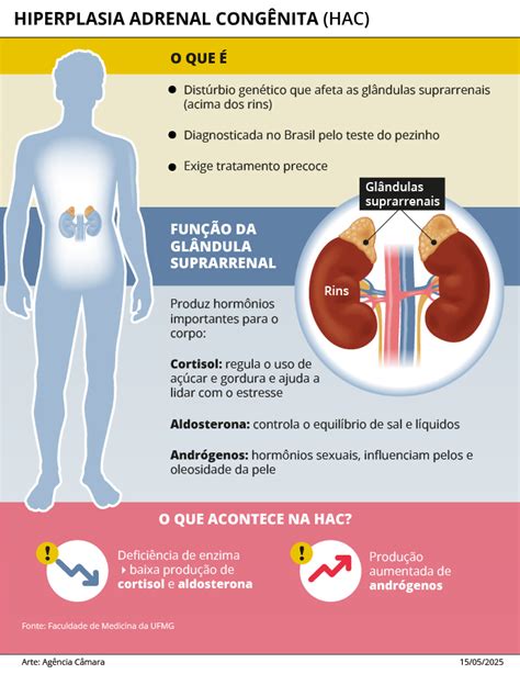 Hiperplasia Adrenal Congênita O Que É - Disturbios Das Funcoes Da Glandula Adrenal Dra. Ana Elisa Rebeschini