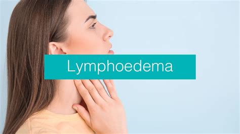 8 Lymphoedema Signs Symptoms Causes Questions