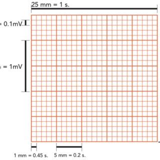 Electrocardiograma con sus ondas intervalos segmentos y su relación