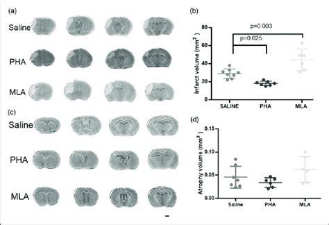 Reduction Of Neuroinflammation Reduced Infarct Volumes A And C