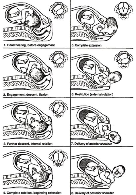 Instructions For How To Use The Eyelidh In Childrens Eyes From An Old