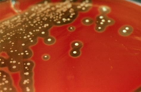 Blood Agar Streptococcus Pyogenes