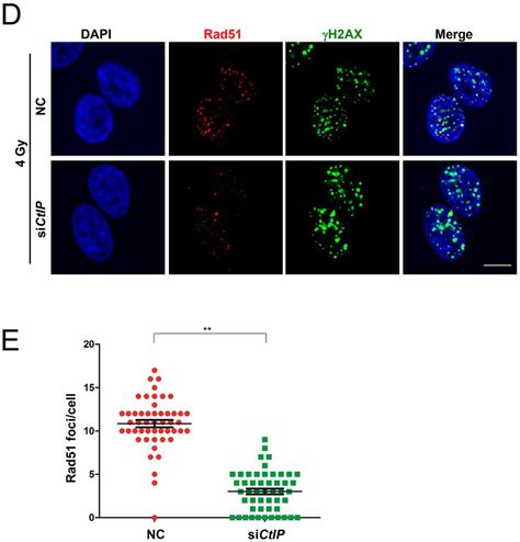 Continued D Wild Type And CtIP Depleted MCF7 Cells Were Irradiated