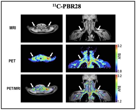 Ijms Free Full Text Molecular Imaging Of Brown Adipose Tissue Mass