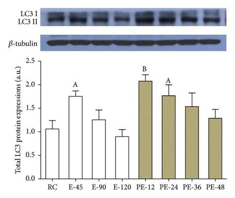 To Investigate The Mitophagy In The Myocardium The Expressions Of