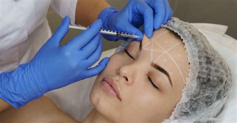 Benefits Of Sculptra Facial Fillers New York Ny